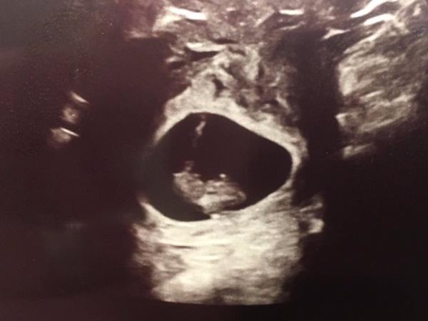 Bild zu Schlusslicht auch zurück vom FA!  - Forum für September - Mamis