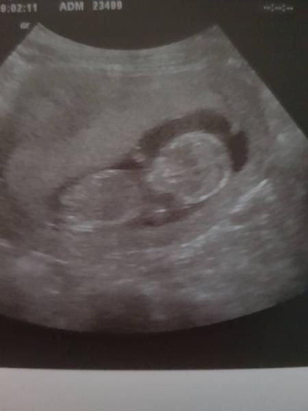Bild zu Grade von FA zurück  - Forum für September - Mamis