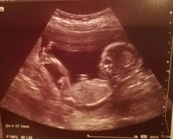 Bild zu Unser Update 3.0 - Forum für September - Mamis