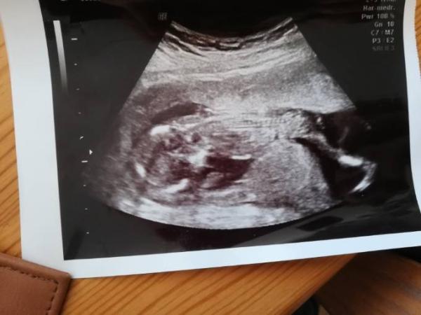 Bild zu Zurück vom FA - Vorsichtiges Outing - Forum für September - Mamis