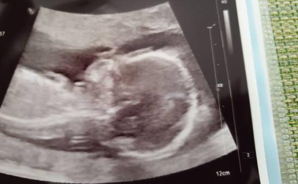 Bild zu Zurück vom FA - Forum für September - Mamis