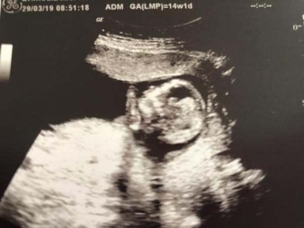 Bild zu Termin und vielleicht eine Aussage :) - Forum für September - Mamis