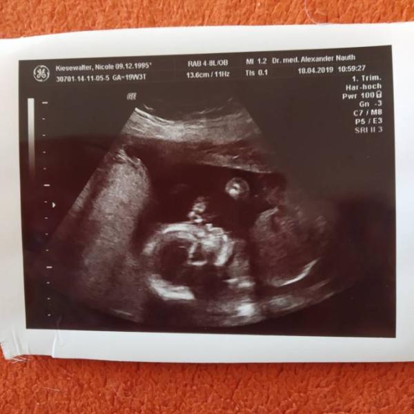 Bild zu Zurück vom Frauenarzt - Forum für September - Mamis