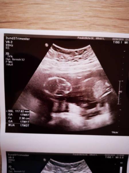 Bild zu Geschlecht? - Forum für September - Mamis