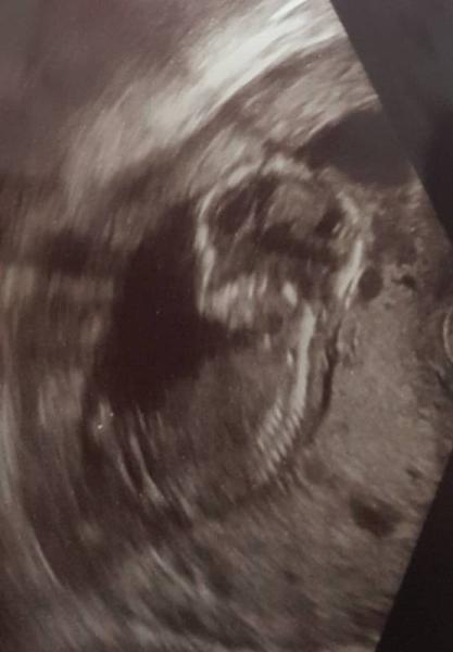 Bild zu Hallo Leute 😊 kenmt sich Jemand mit der Nub Theorie aus? - Forum für September - Mamis