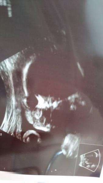 Bild zu Mein Alienkind 👽 - Forum für September - Mamis