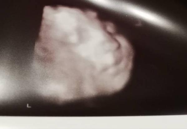 Bild zu Eine Woche weiter geschätzt... - Forum für September - Mamis