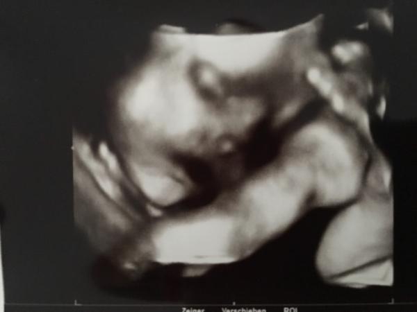 Bild zu Auch wir hatten die 3. große Vorsorge....💙 - Forum für September - Mamis