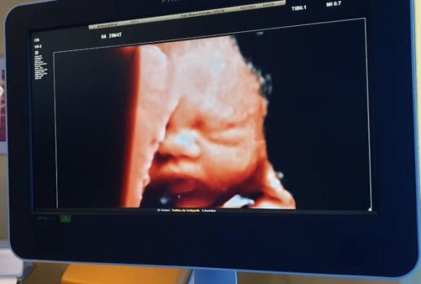Bild zu Regulärer Termin - Forum für September - Mamis