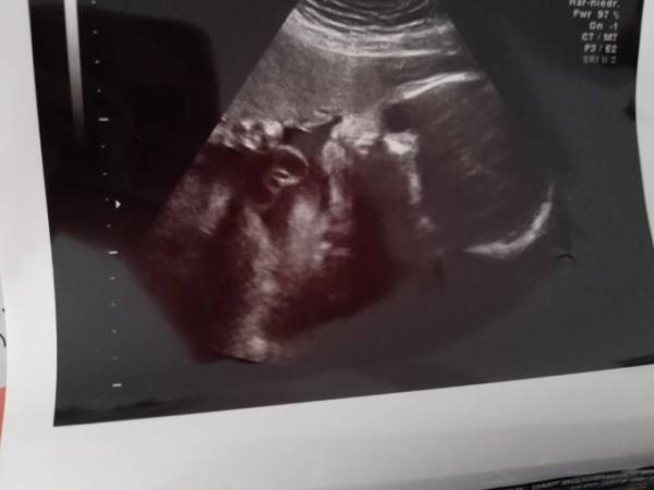 Bild zu Zurück vom FA - Forum für September - Mamis