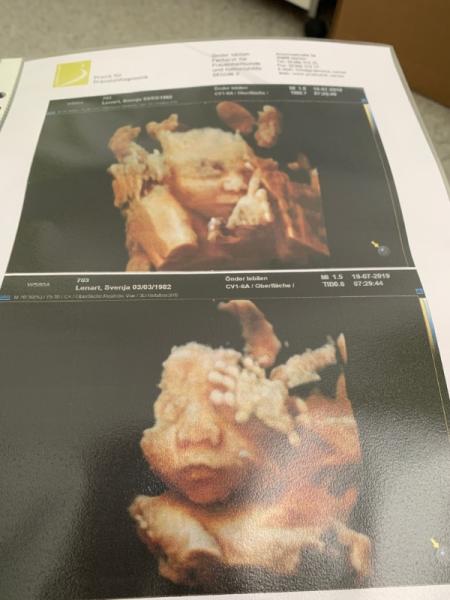 Bild zu Letzte grosse Untersuchung - Forum für September - Mamis