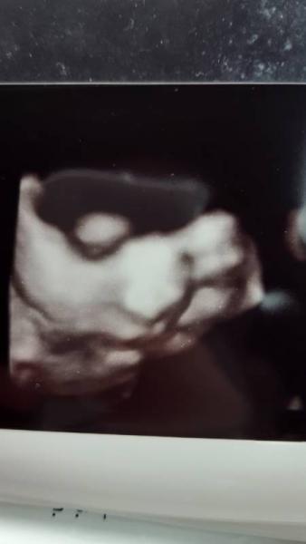 Bild zu Vorsorge und tolles Bild - Forum für September - Mamis