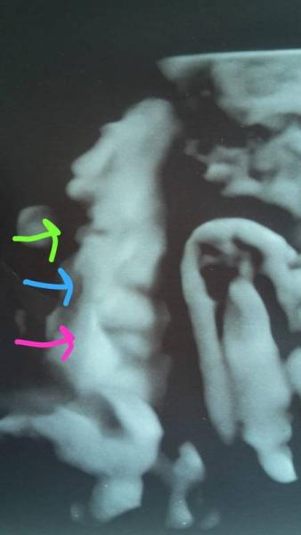 Bild zu Bild vom US 35. SSW - Forum für September - Mamis