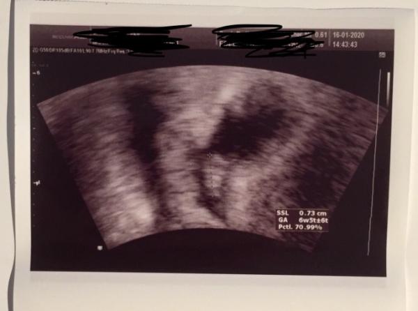 Bild zu 1. Termin beim FA :) - Forum für September - Mamis