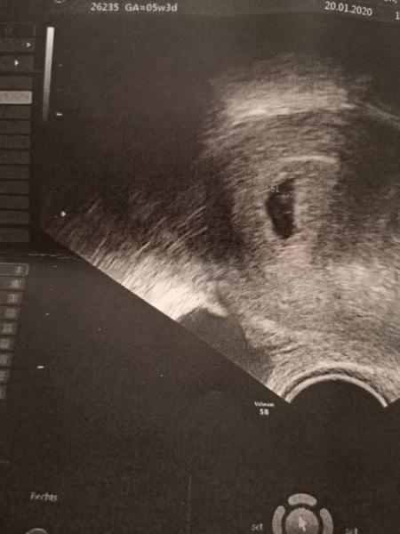 Bild zu FA Termin - Forum für September - Mamis