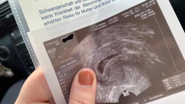 Bild zu Guten Morgen kleinen Erbsen ❤️ - Forum für September - Mamis