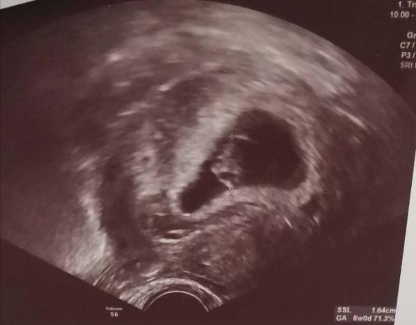 Bild zu Auch zurück vom Gyn 💞 - Forum für September - Mamis