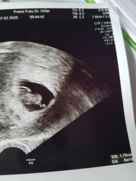 Bild zu Zurück vom Arzt  - Forum für September - Mamis