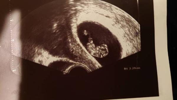 Bild zu Kopfschmerzen darf ich? - Forum für September - Mamis