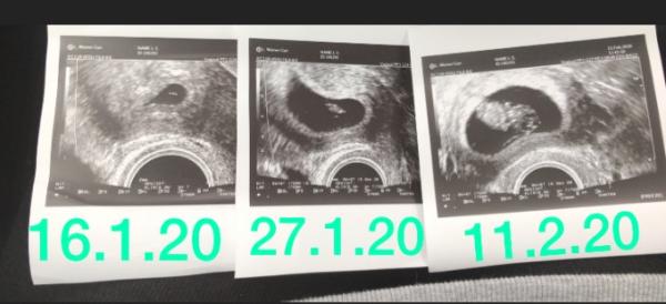Bild zu Zurück vom FA - Forum für September - Mamis