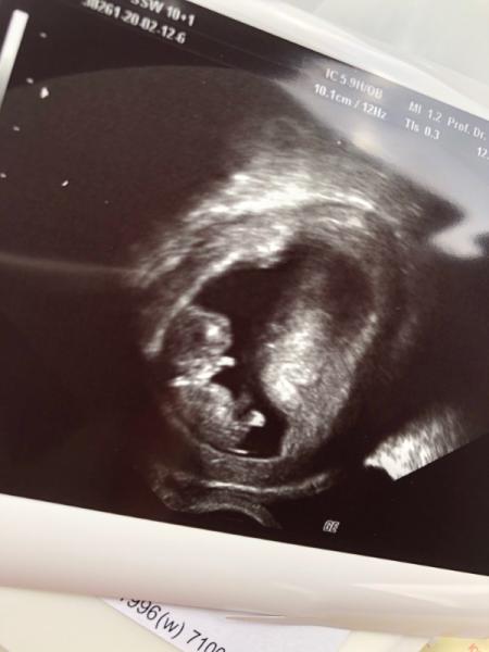 Bild zu Nächster Termin und Ständiges unwohlsein - Forum für September - Mamis