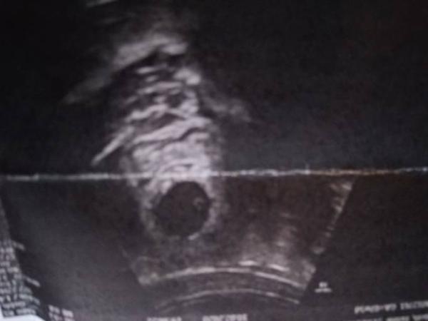 Bild zu Eckenhocker??? - Forum für September - Mamis