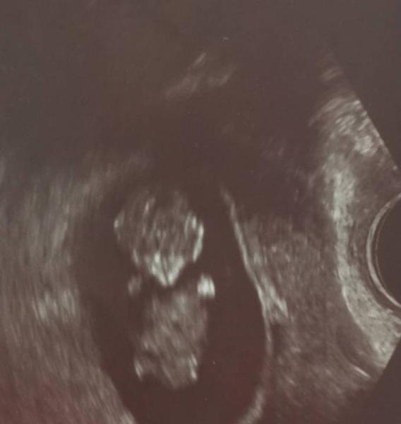 Bild zu Auch zurück vom Gyn - Forum für September - Mamis