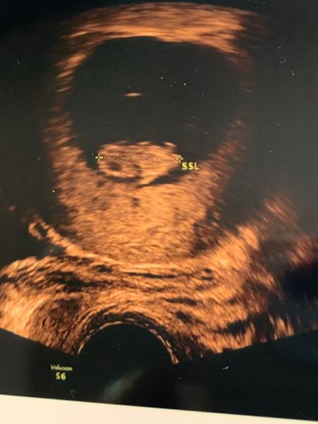 Bild zu Endlich auch zweistellig 😍 - Forum für September - Mamis