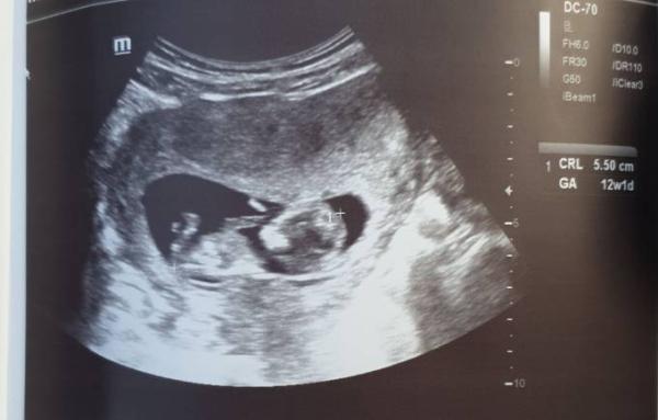 Bild zu Zurück vom FA - Forum für September - Mamis