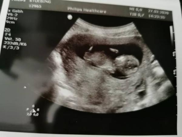 Bild zu Heute Praena Test gehabt - bin gespannt 🙏🏼 - Forum für September - Mamis
