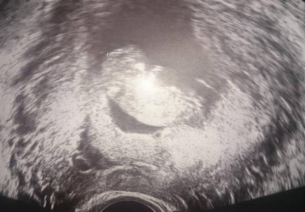 Bild zu Darf ich noch mit Fahren?:) - Forum für September - Mamis