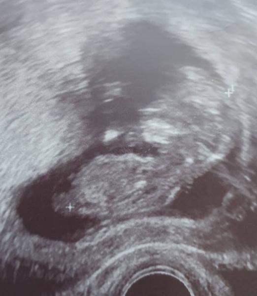 Bild zu Mädchen oder Junge ? - Forum für September - Mamis