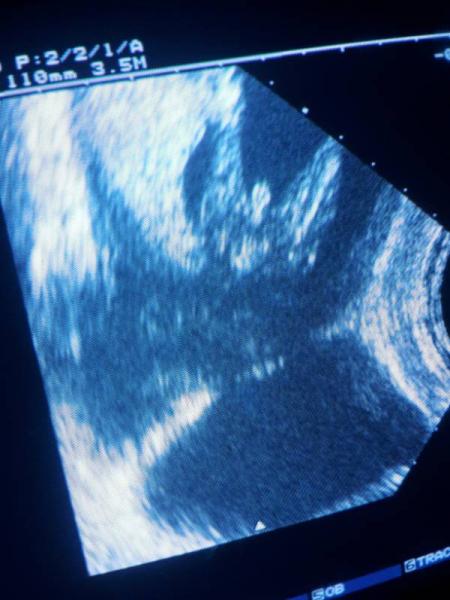 Bild zu Geschlecht?  - Forum für September - Mamis
