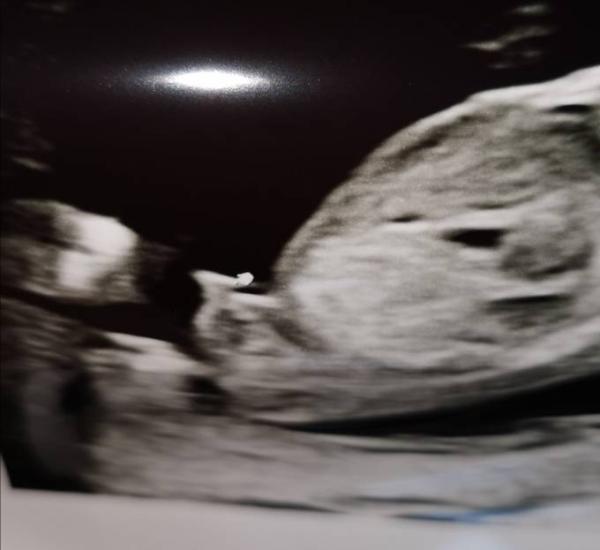 Bild zu Sieht es für euch aus wie ein Junge? - Forum für September - Mamis