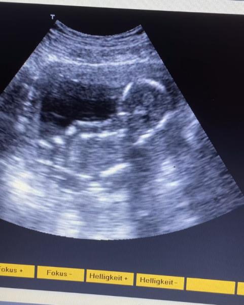 Bild zu Babywatcher - Forum für September - Mamis