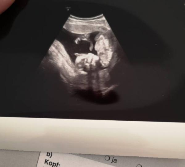 Bild zu FA Termin - Forum für September - Mamis