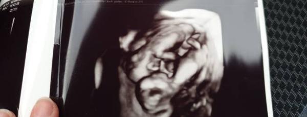 Bild zu Fertig.... - Forum für September - Mamis