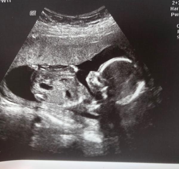 Bild zu Zurück von der VU - Forum für September - Mamis