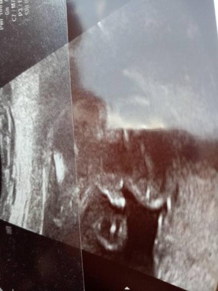 Bild zu Zurück vom FA - Forum für September - Mamis
