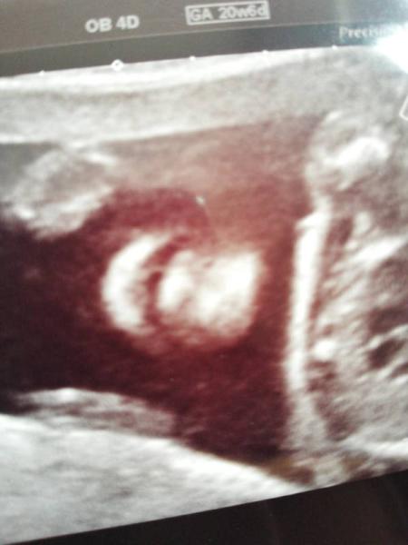 Bild zu Zurück vom FA - Forum für September - Mamis