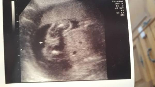 Bild zu Junge oder Mädchen - Forum für September - Mamis