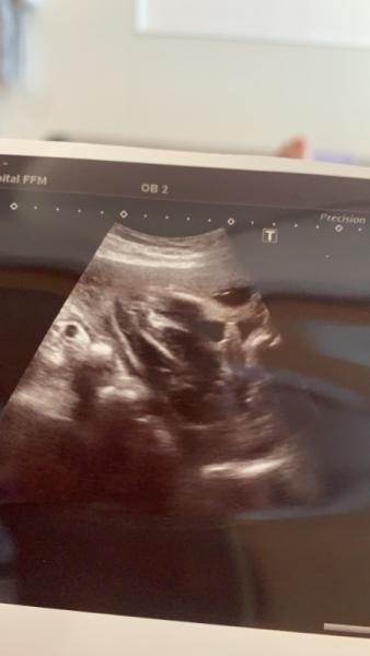 Bild zu Klar und deutlich... - Forum für September - Mamis