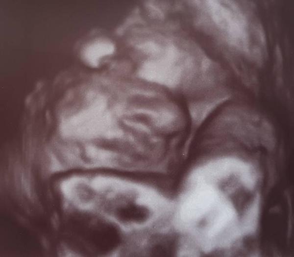 Bild zu Wachstumsschub In dem Ausmaß? - Forum für September - Mamis