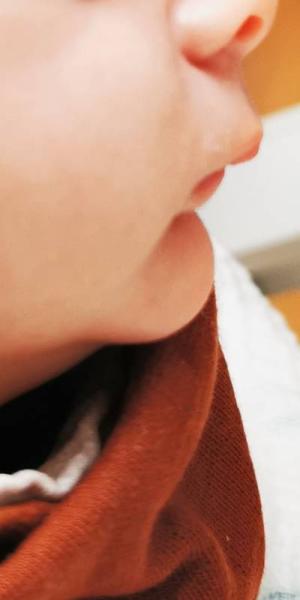Bild zu Unterkiefers Baby weiter hinten.... - Forum für September - Mamis