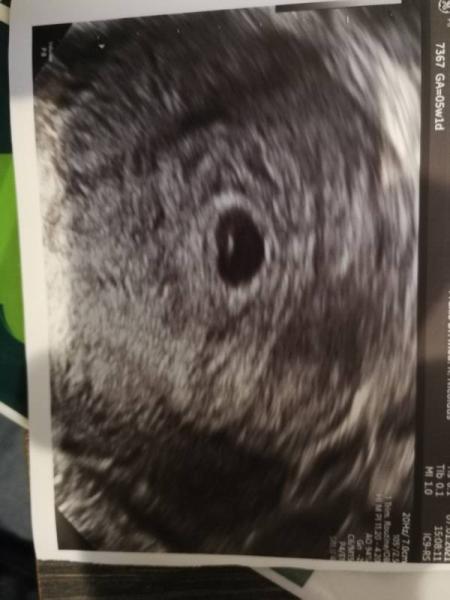Bild zu Update neuer Frauenarzt - Forum für September - Mamis