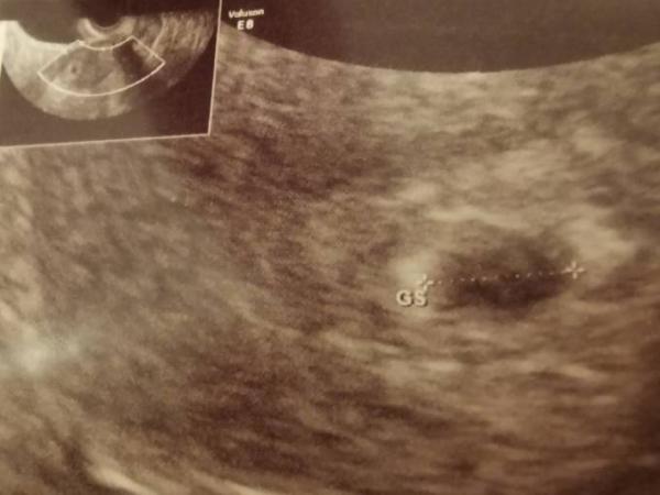 Bild zu Komme auch dazu :) - Forum für September - Mamis