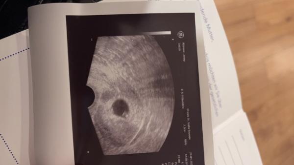 Bild zu Kein Embryo - Forum für September - Mamis