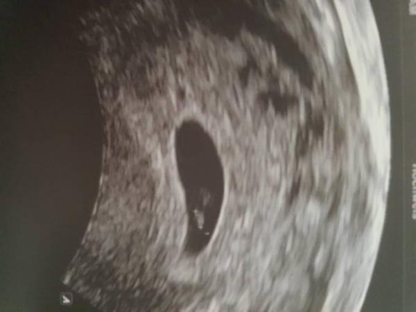 Bild zu Einfach nur happy - Forum für September - Mamis