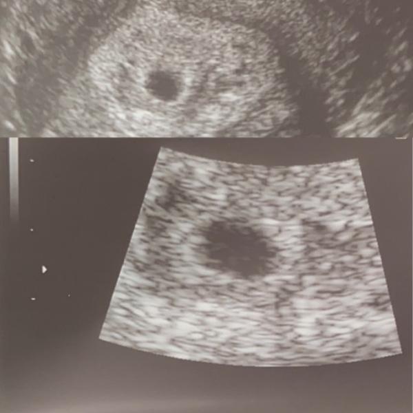 Bild zu Ultraschall - Forum für September - Mamis