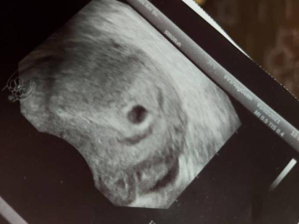 Bild zu .. eure Meinung - Forum für September - Mamis